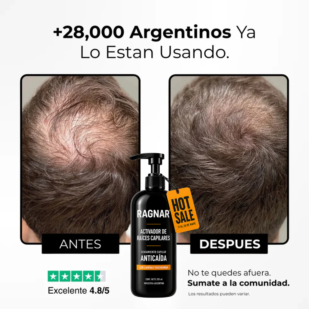 RAGNAR® - Tratamiento Profesional Activador de Raices Capilares