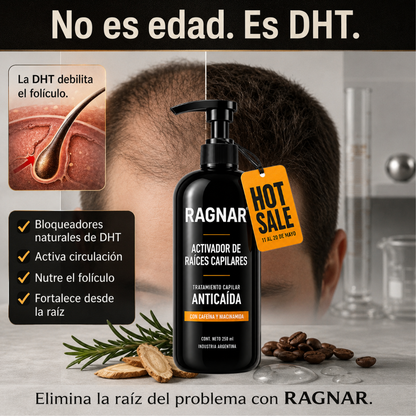 RAGNAR® - Tratamiento Profesional Activador de Raices Capilares